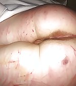 Imgur